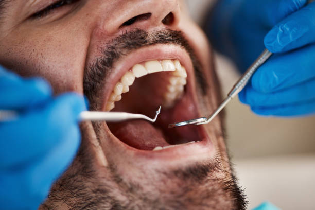 Best Dentist Open Late Near Me  in Lake Mawk, OH