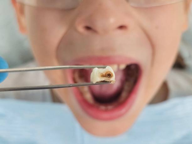 Best Emergency Dental Services Near Me  in Lake Mawk, OH